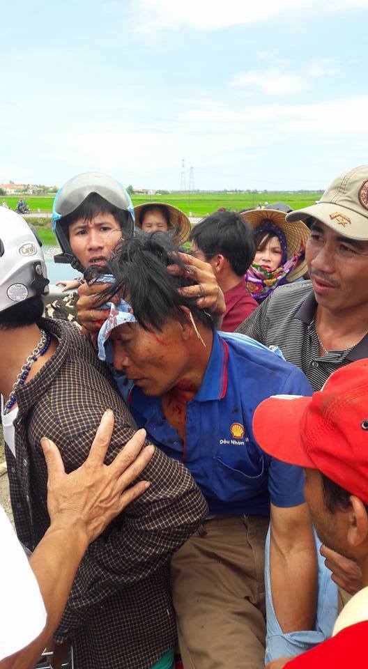 July 2016: Violence against Formosa protesters by polices.