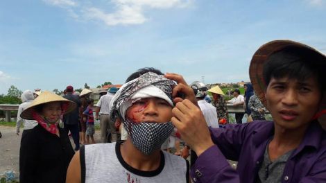 July 2016: Formosa protester beaten up by polices.